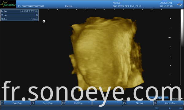 image for labtop ultrasound